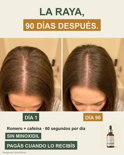 La raya, a los 90 días — imagen ilustrativa
