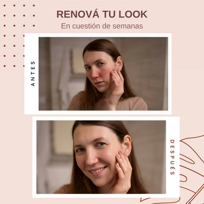 CALMA™ | Serum Facial que Empareja el tono y suaviza las marcas