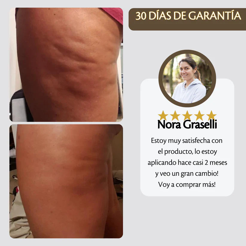 Aceite Reafirmante Anti-celulítico - M3