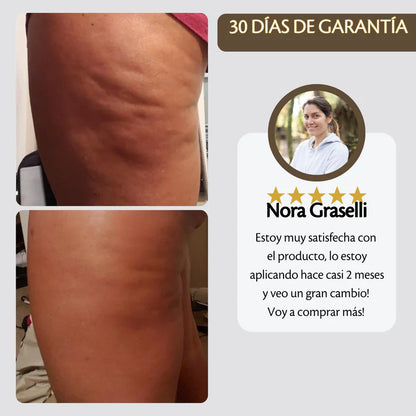 Aceite Reafirmante Anti-celulítico M3 | 2x1!
