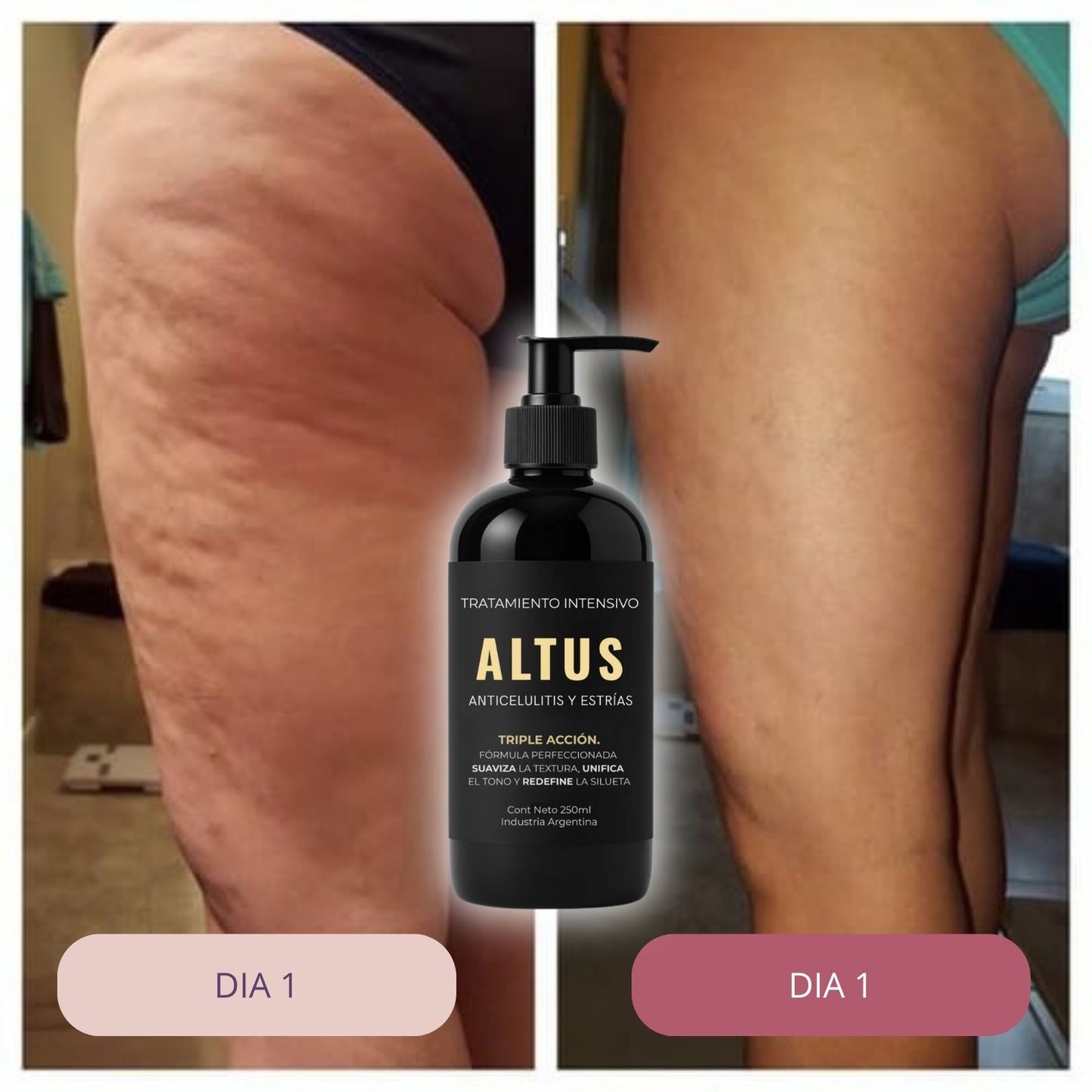 ALTUS COSMETICS | Cosmética Premium, reducción de celulitis, flacidez y arrugas