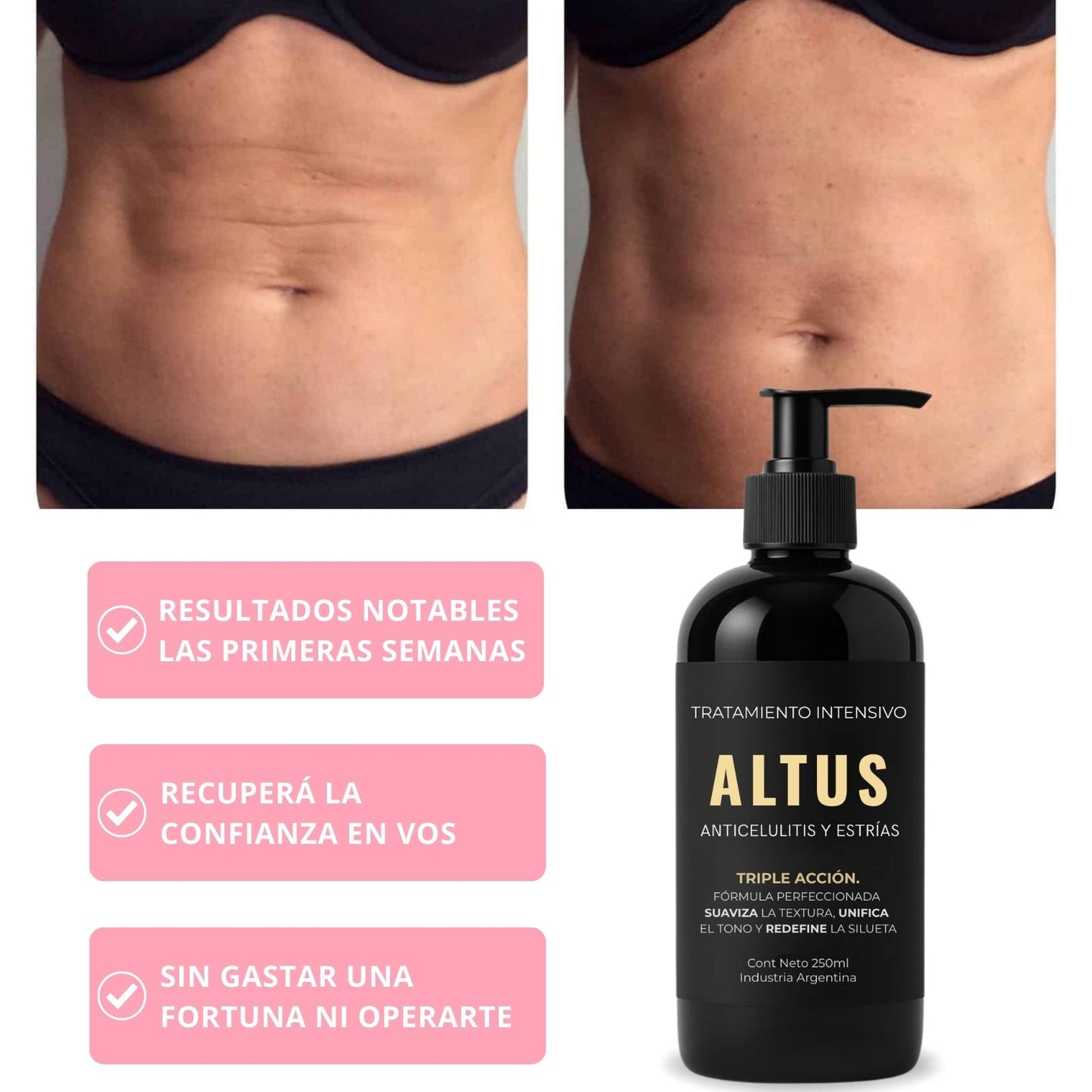 ALTUS COSMETICS | Cosmética Premium, reducción de celulitis, flacidez y arrugas