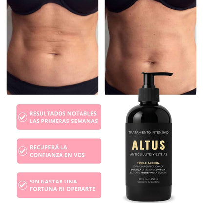 ALTUS COSMETICS | Cosmética Premium, reducción de celulitis, flacidez y arrugas