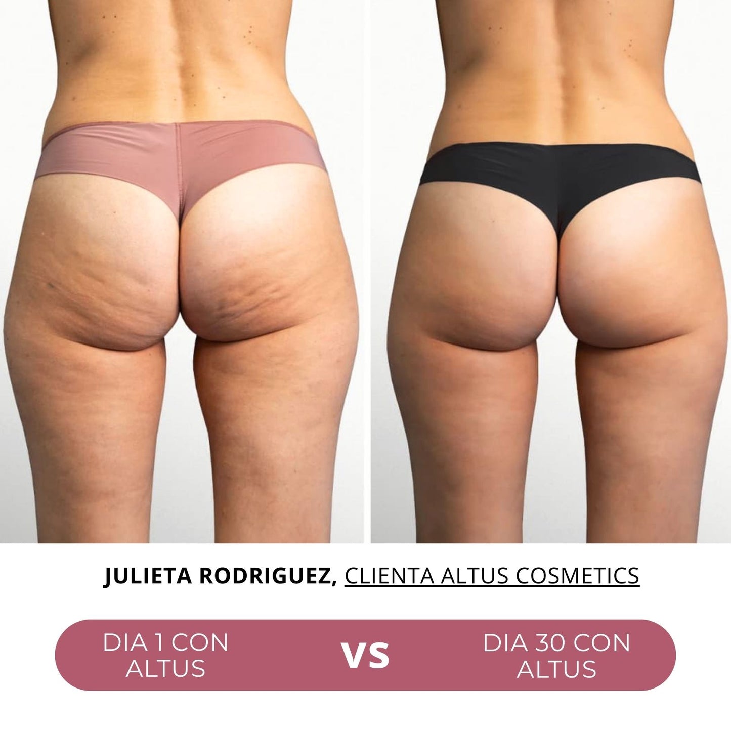ALTUS COSMETICS | Cosmética Premium, reducción de celulitis, flacidez y arrugas