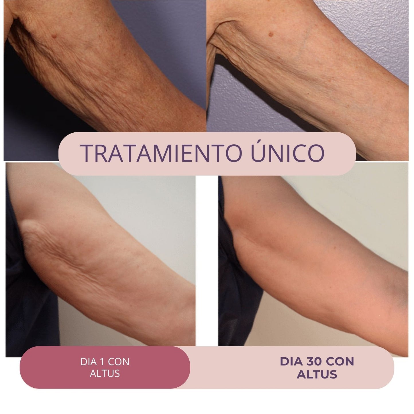 ALTUS COSMETICS | Cosmética Premium, reducción de celulitis, flacidez y arrugas